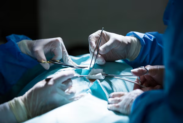 Laparoscopy For Pseudopancreatic Cysts