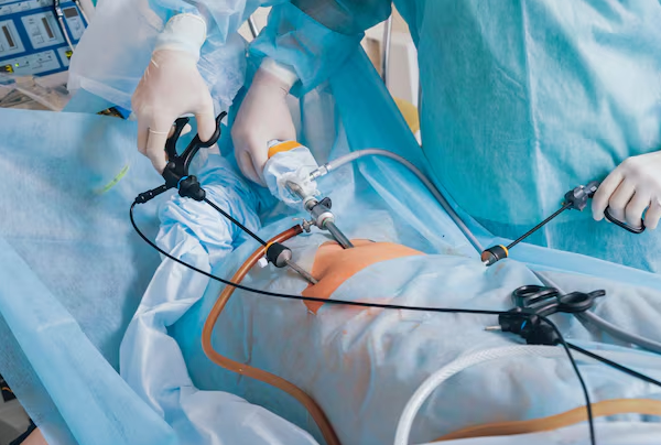 Laparoscopy In Various Liver Cysts