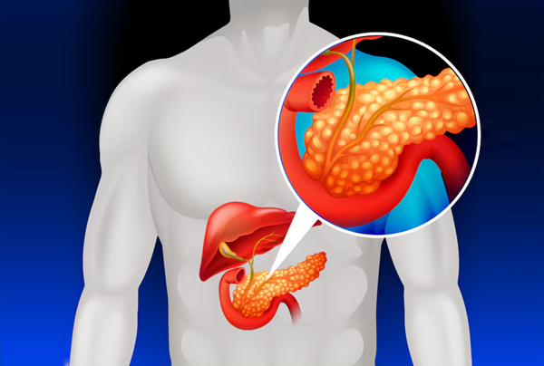 Laparoscopic Radical Cholecystectomy