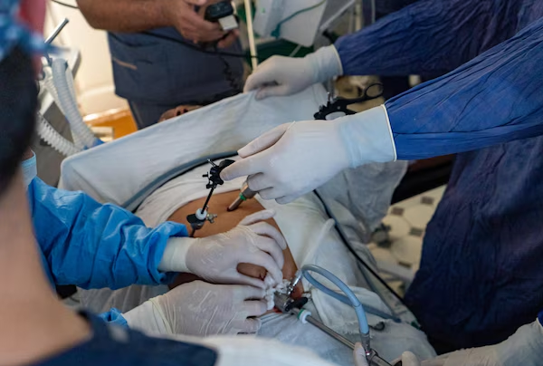Laparoscopic For Rectal Prolapse