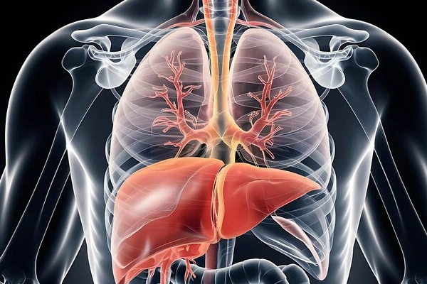 Hiatus Hernia Surgery