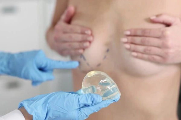 Breast Augmentation
