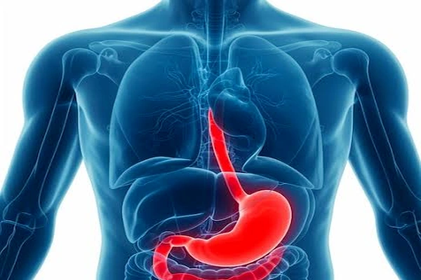 Left Hemicolectomy