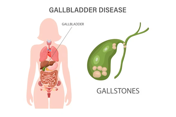 Gall Bladder