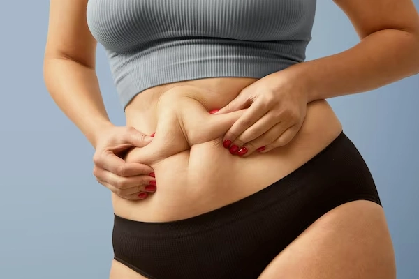 Rectal Prolapse