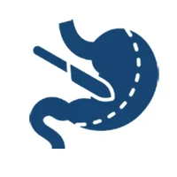 Bariatric Surgery